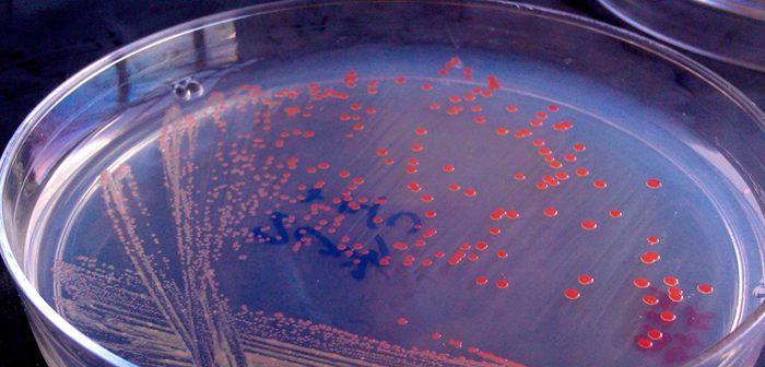 KnipBio es la primera empresa que consigue cultivar bacterias productoras de carotenoides (esenciales para el crecimiento de los pescados) y obtener acreditación comercial en EE. UU. Sin embargo siguen recibiendo críticas acerca del posible escape de cepas modificadas genéticamente.